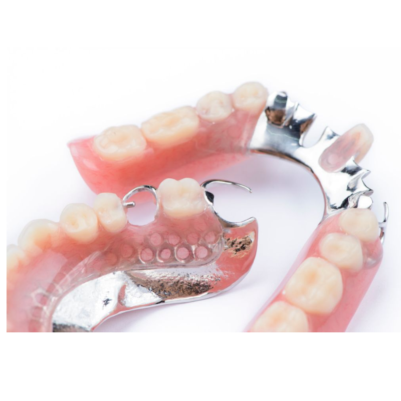 Prótese parcial removível com estrutura metálica e dentes artificiais.