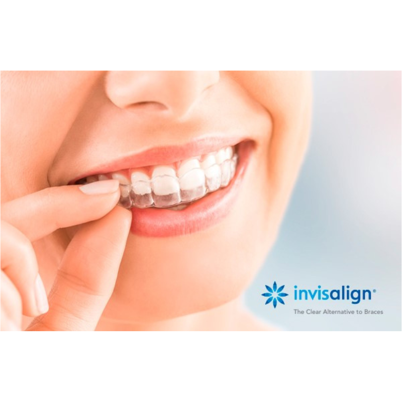 Sorriso com Invisalign