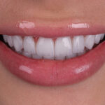 Sorriso da Rebeca