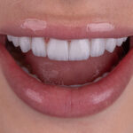 Sorriso da Rebeca