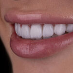 Sorriso da Rebeca