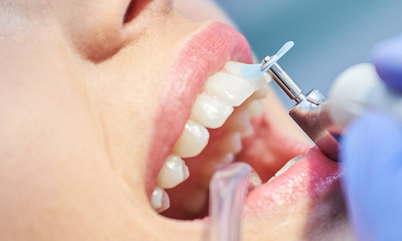 Dentes sendo limpo